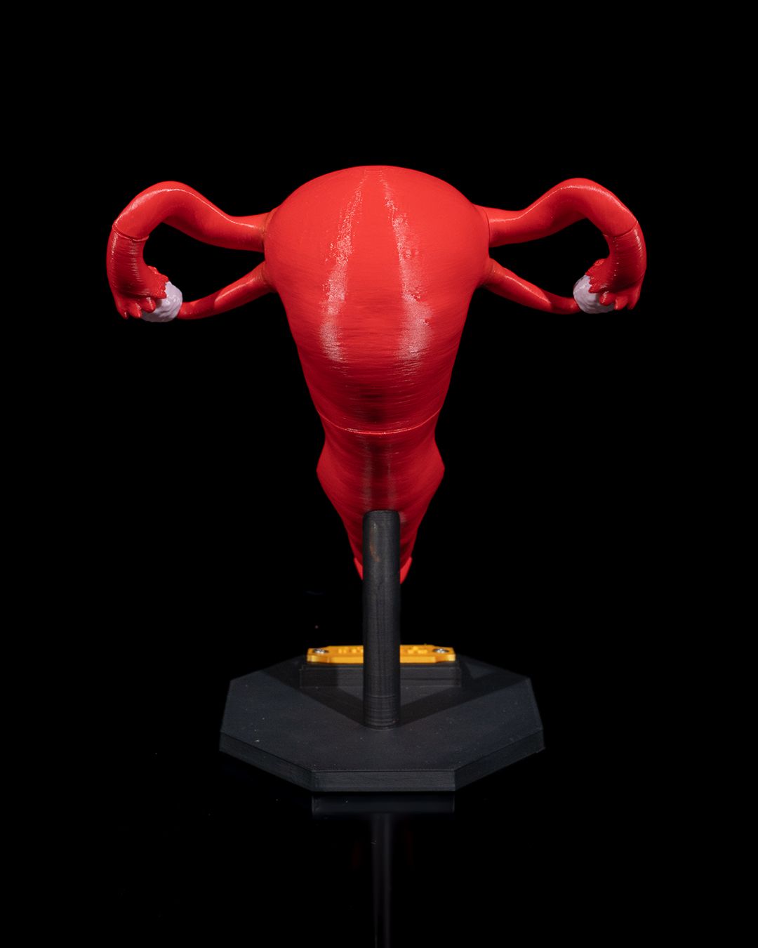 Uterus educational model